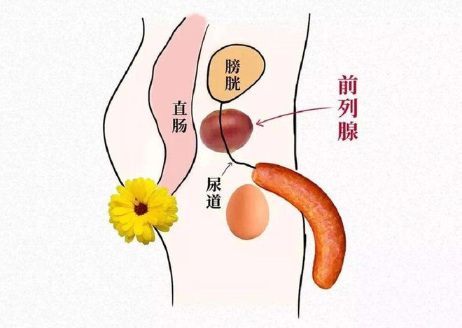雷竞技RAYBET·(中国)官方网站光邦光子治疗仪：前列腺越大越好？男性的“超级(图3)